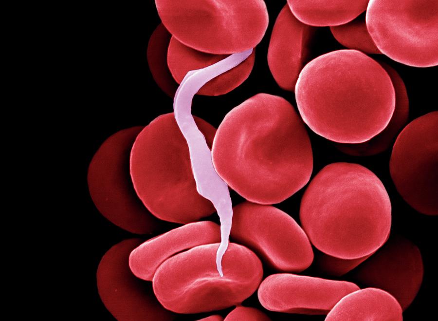 Blood Photograph - Trypanosome Amongst Blood Cells #1 by Clouds Hill Imaging Ltd