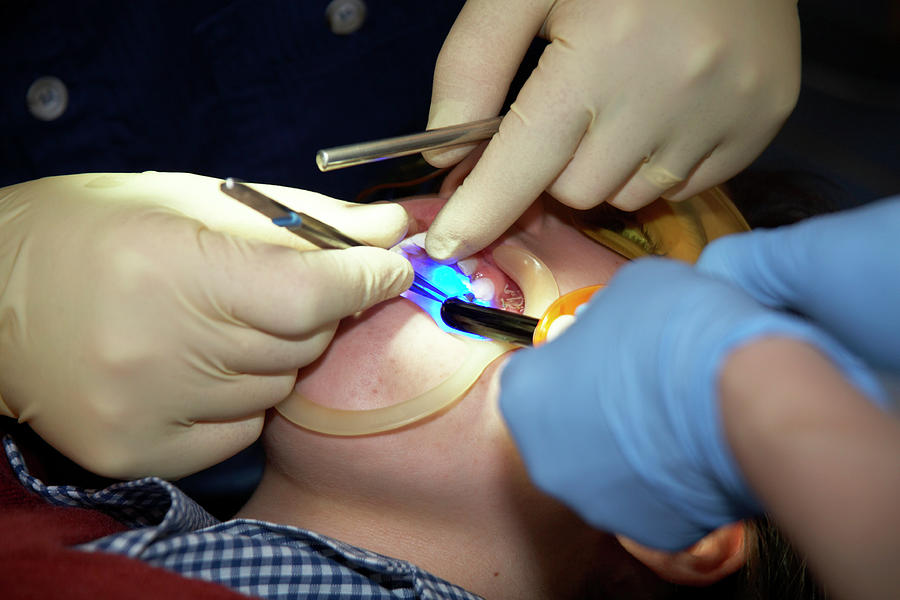 Undescended Tooth Treatment #1 Photograph by Antonia Reeve/science Photo Library