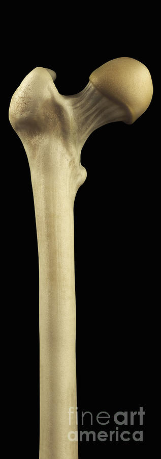 Skeleton Photograph - Upper Femur #1 by Science Picture Co