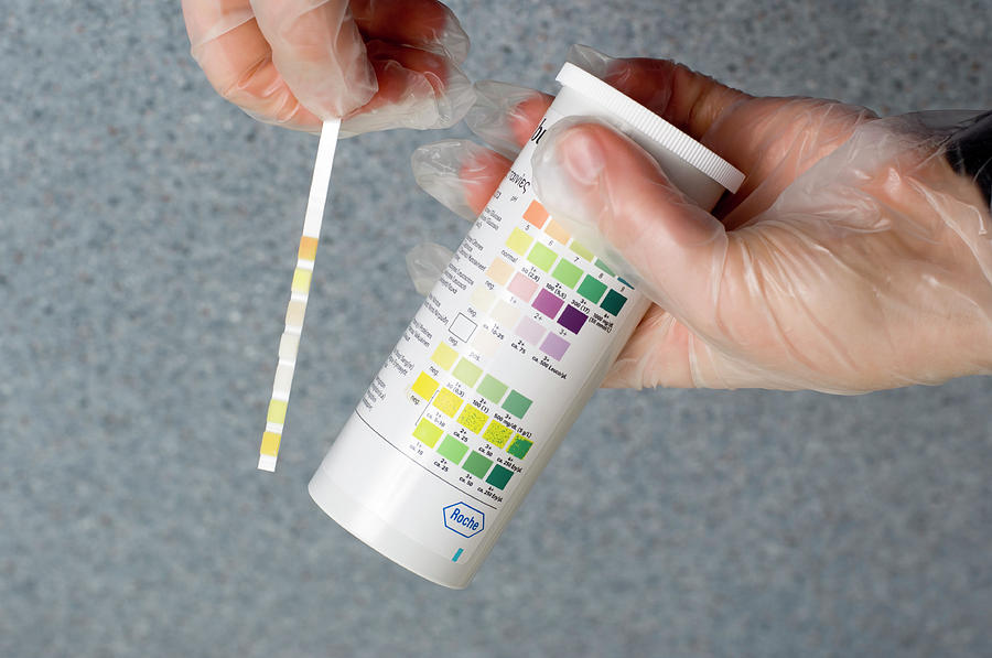 urine-analysis-photograph-by-jim-varney-science-photo-library-pixels