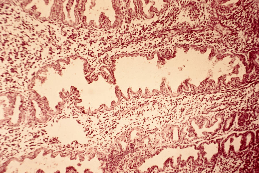 Uterus #1 Photograph by Biology Pics