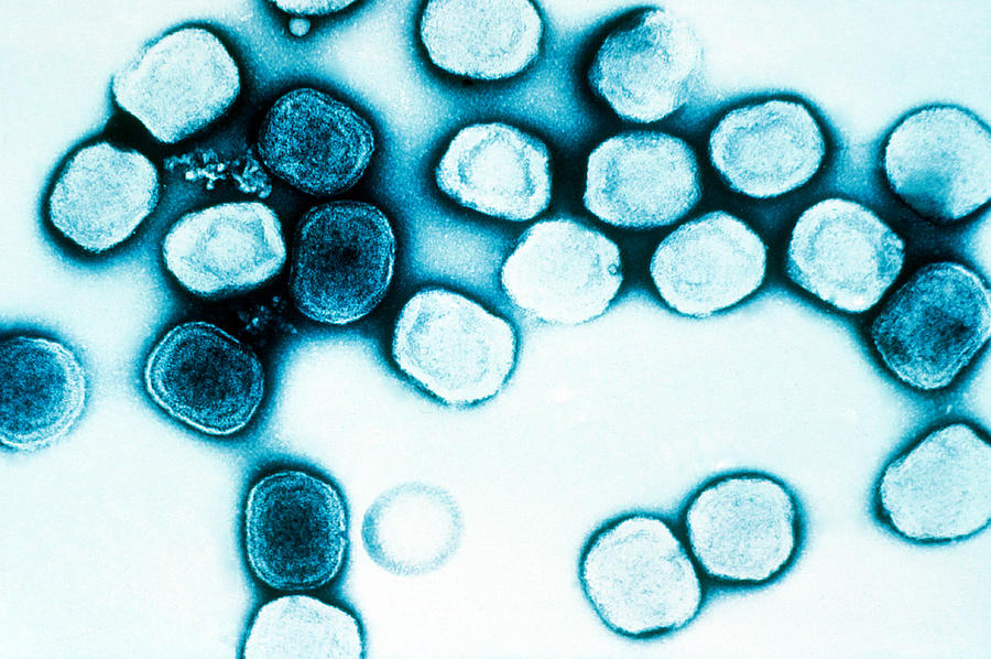 Vaccinia Virus, Eradicated Smallpox, Tem #1 Photograph by Science Source