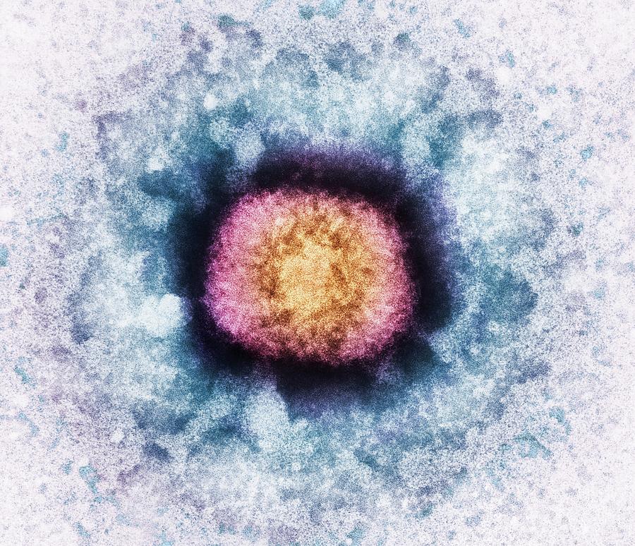 Vaccinia Photograph - Vaccinia Virus Particle #1 by Heather Davies/science Photo Library