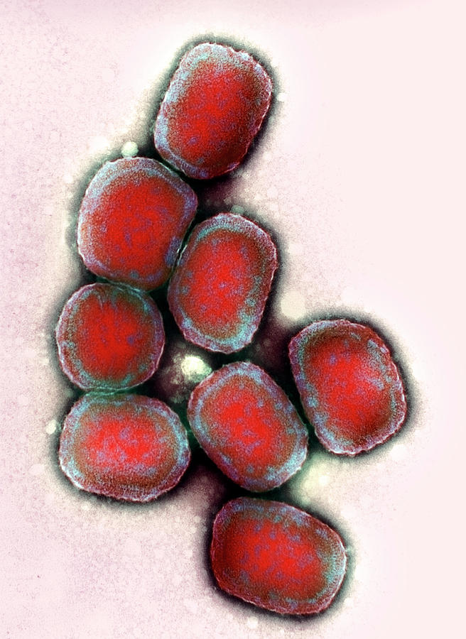 Vaccinia Virus Particles #1 Photograph by A. Dowsett, Public Health England/science Photo Library
