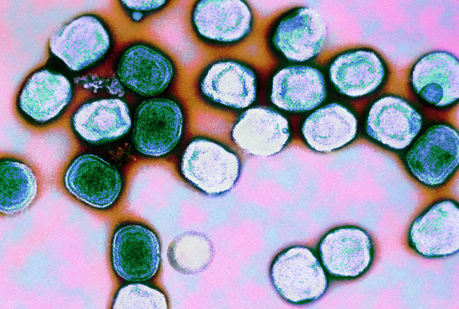 Vaccinia Virus Particles #1 Photograph by Cdc/science Photo Library