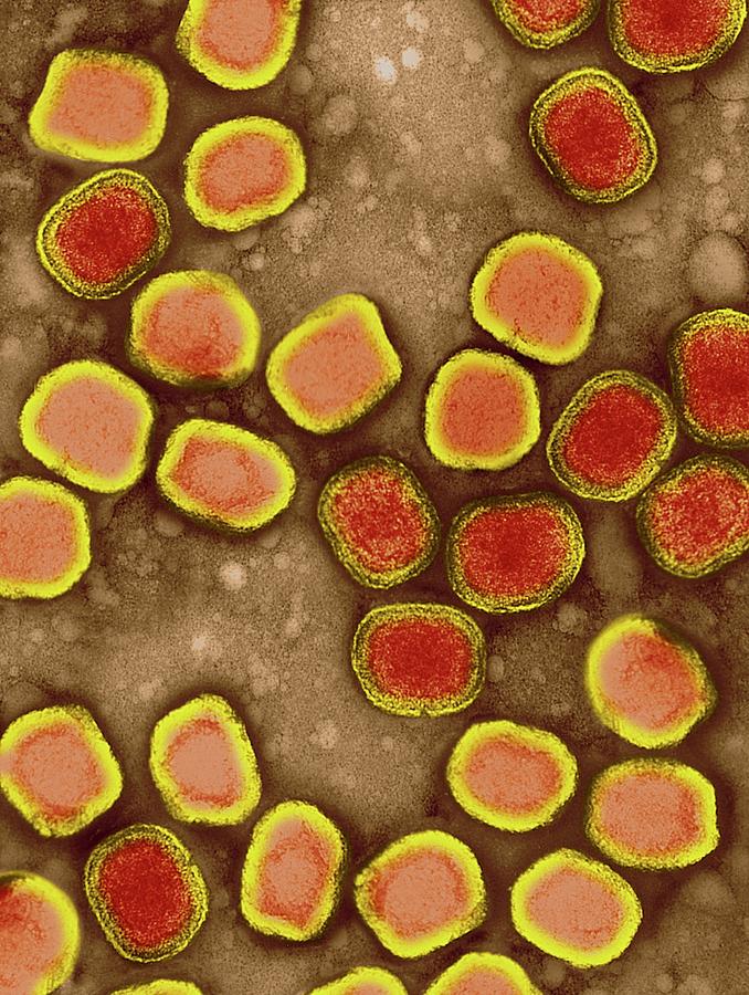Variola Virus #1 Photograph by Dennis Kunkel Microscopy/science Photo Library