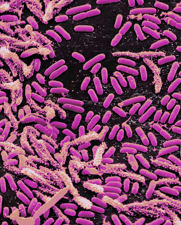 Vibrio Bacteria, Sem #1 Photograph by Science Source