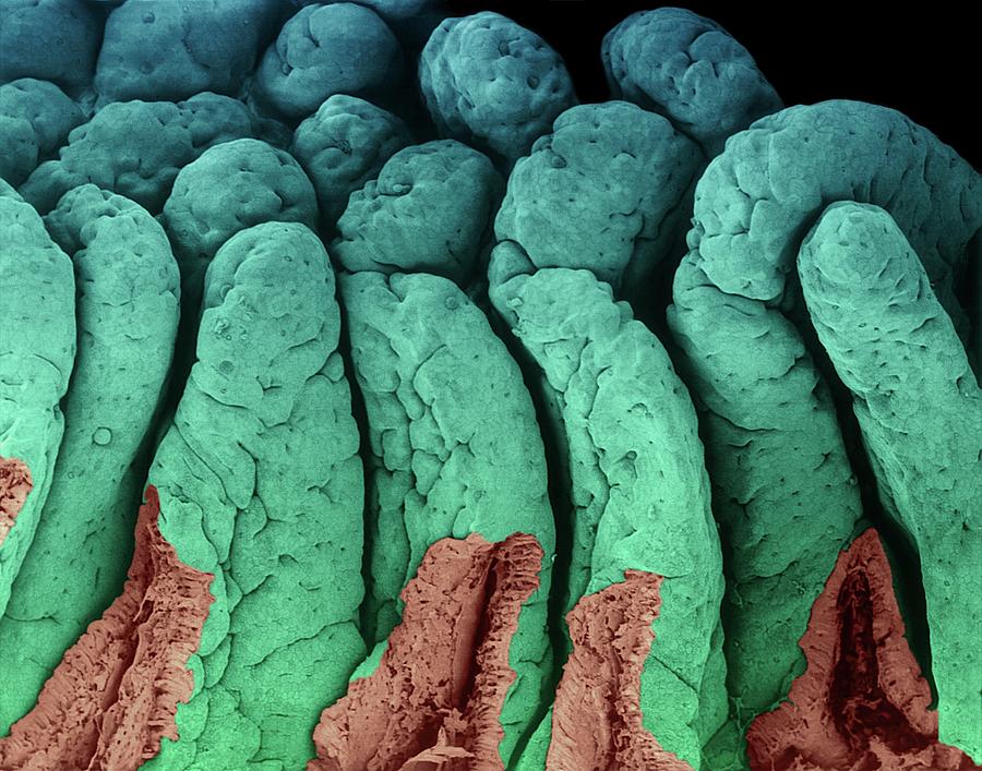 Villi Of The Small Intestine #1 Photograph by Dennis Kunkel Microscopy/science Photo Library