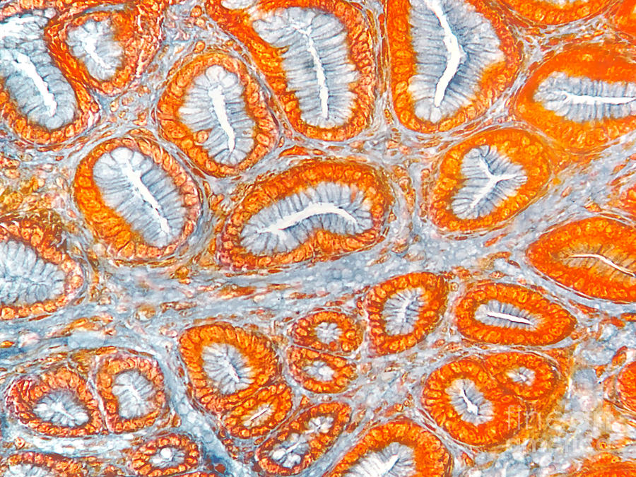 Stomach Photograph - Villi, Pyrloric Stomach Of Cat Lm #1 by Garry DeLong