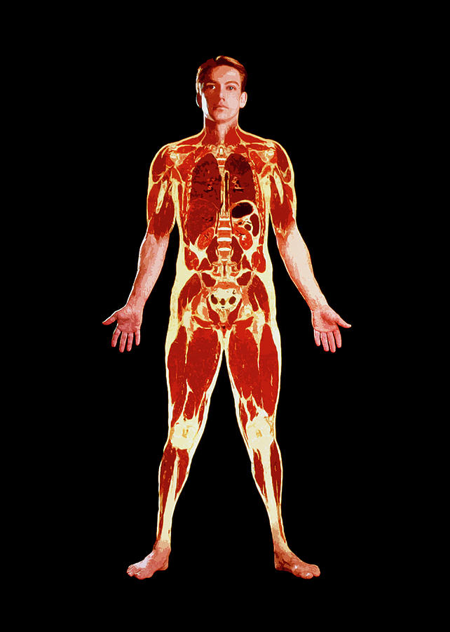 Visible Human Project: Sectioned Male Body (front) Photograph by Mehau