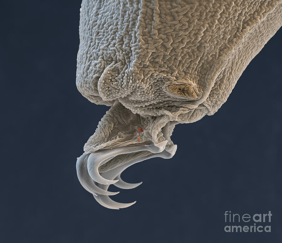 Animal Photograph - Water Bear Leg #1 by Eye of Science and Science Source