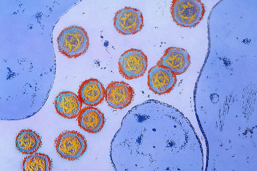 West Nile Virus Tem #1 Photograph by Chris Bjornberg