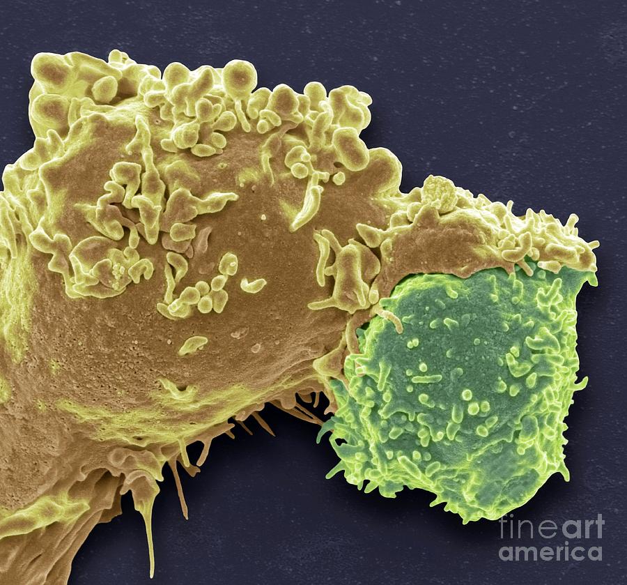 Scanning Electron Micrograph Photograph - White Blood Cell Antigen Presentation #1 by Steve Gschmeissner