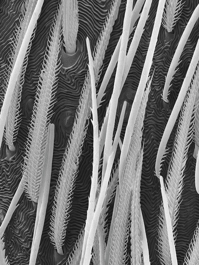 Wolf Spider Abdomen Hairs #1 Photograph by Dennis Kunkel Microscopy/science Photo Library
