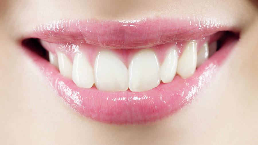 Woman's Mouth Photograph by Kate Jacobs/science Photo Library | Fine ...