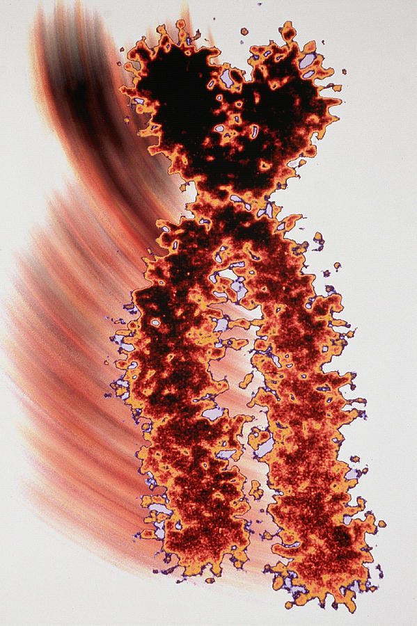 X Chromosome #1 Photograph by Joubert