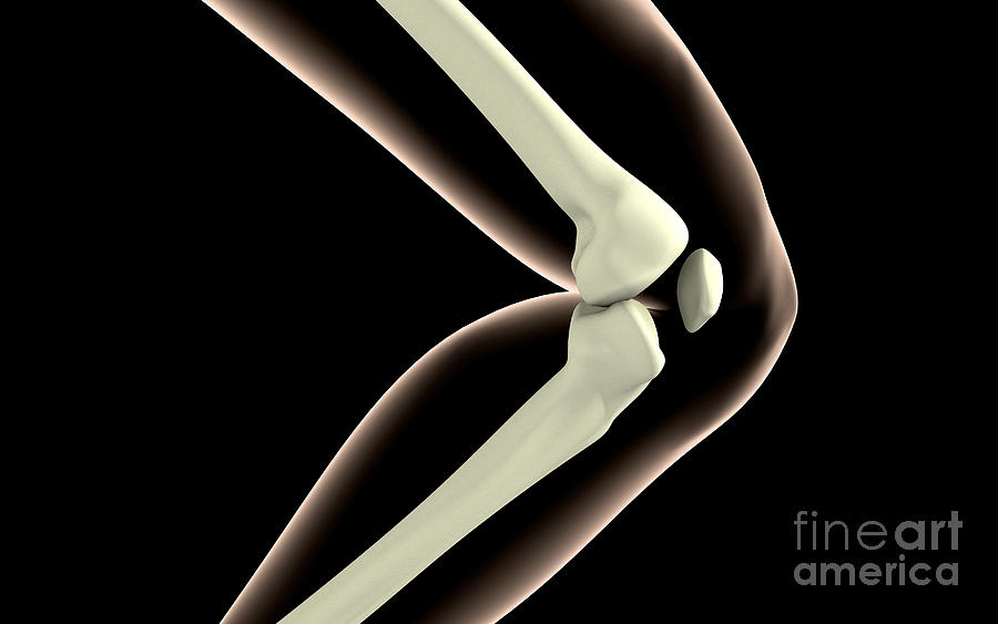 Anatomy Digital Art - X-ray Image Of Knee #1 by Stocktrek Images