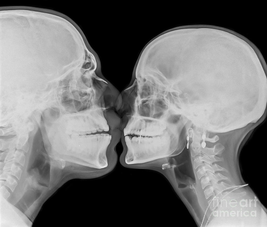 X-ray kissing #1 Photograph by Guy Viner