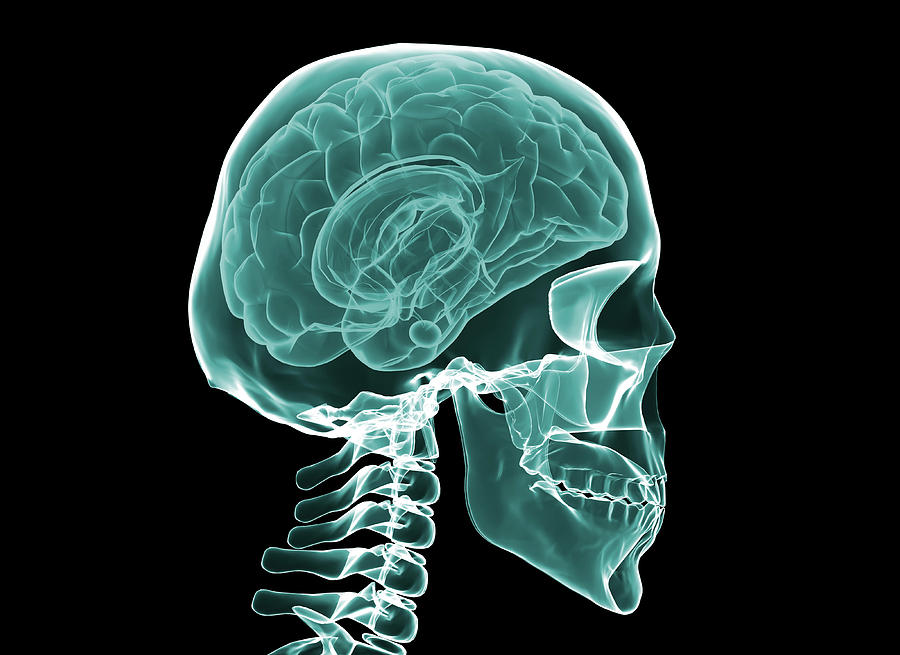 X-ray Of The Human Brain And Skull Photograph by Jesper Klausen ...