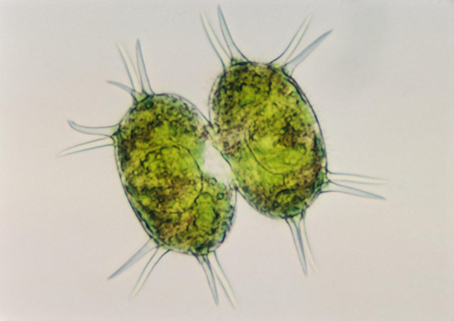 Xanthidium Sp. Algae Lm #1 Photograph by Winton Patnode