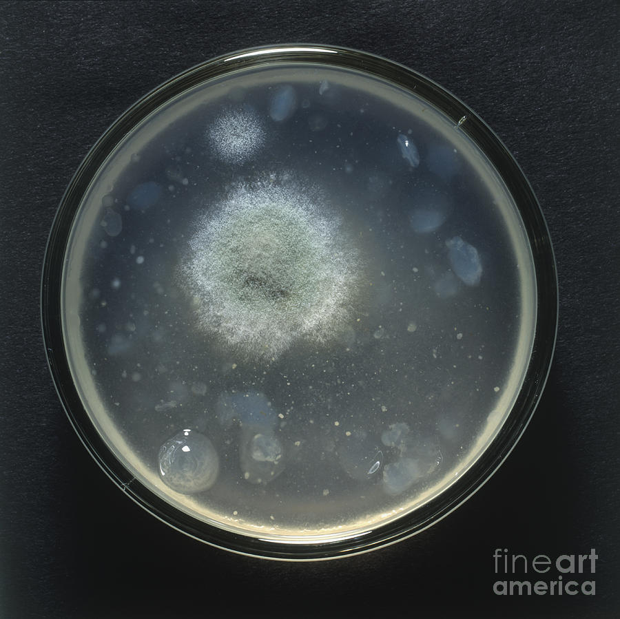 Yeast Culture In Petri Dish #1 Photograph by Frank Greenaway / Dorling Kindersley