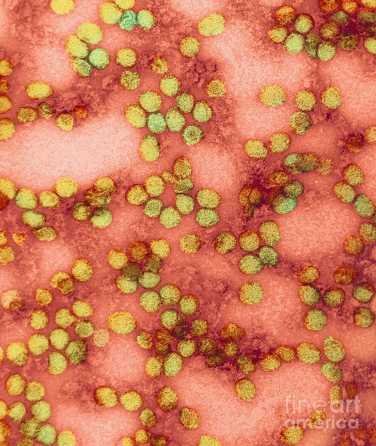Yellow Fever Virus Particles, Tem Photograph by Ami Images - Fine Art