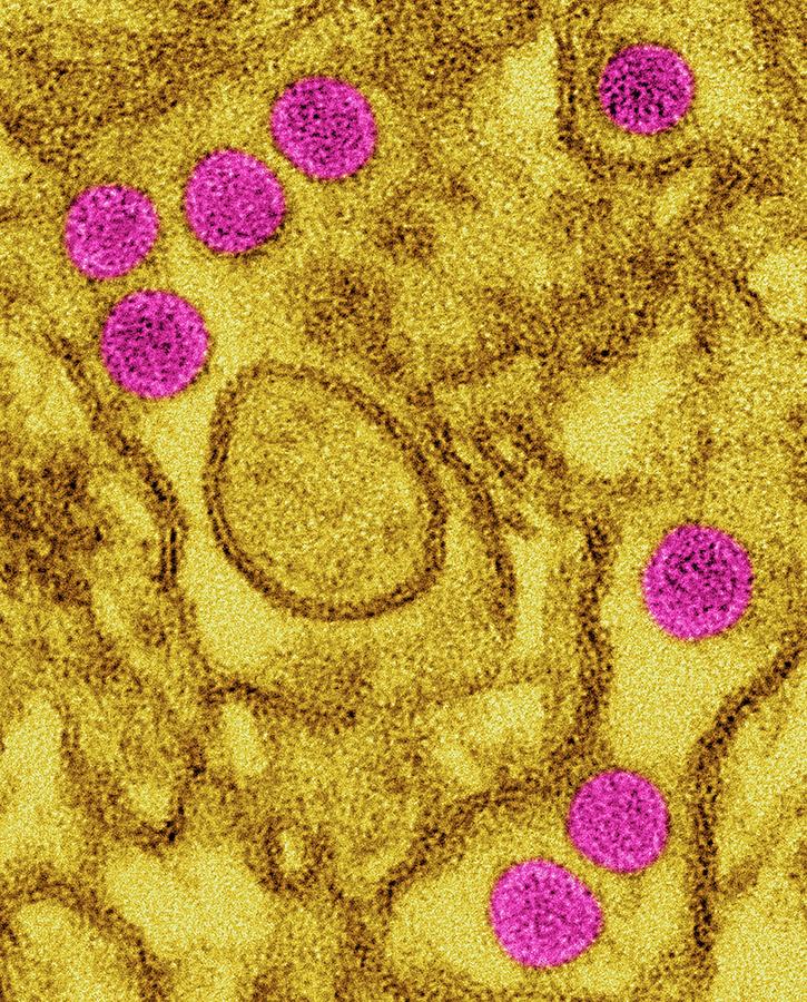 Zika Virus #1 Photograph by Dennis Kunkel Microscopy/science Photo Library