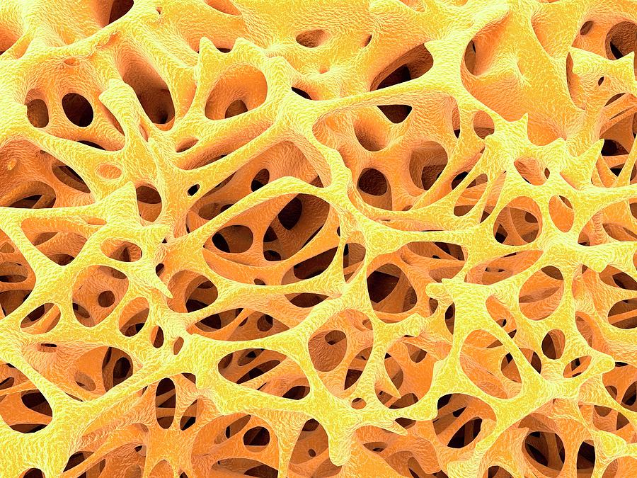 Anatomy Photograph - Bone Tissue #10 by Alfred Pasieka/science Photo Library