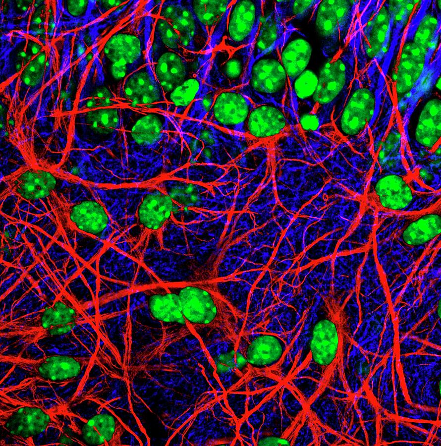 Brain Cells #10 Photograph by Dr. Chris Henstridge