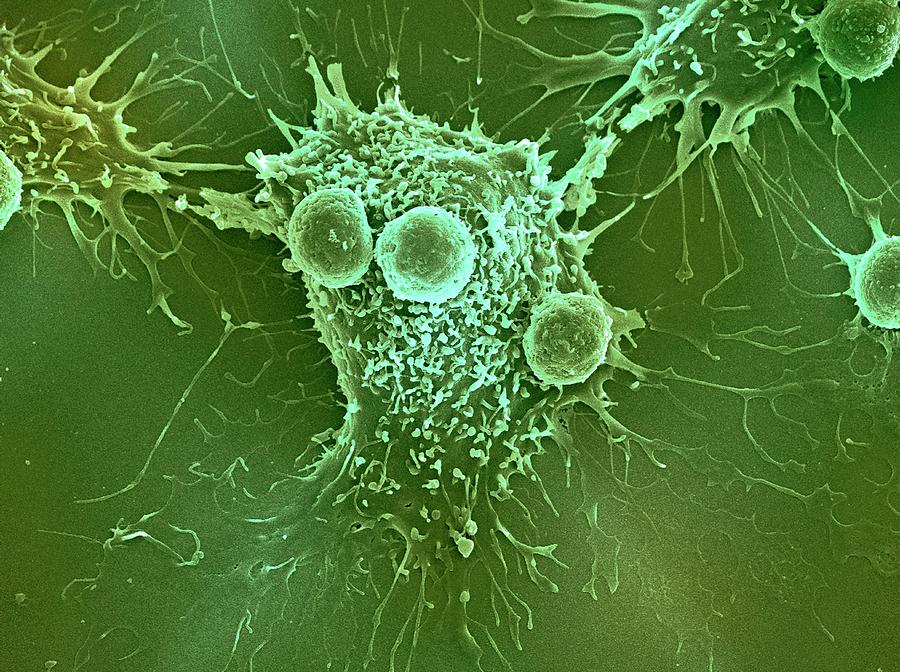 Cancer Cell And T Lymphocytes #10 Photograph by Steve Gschmeissner