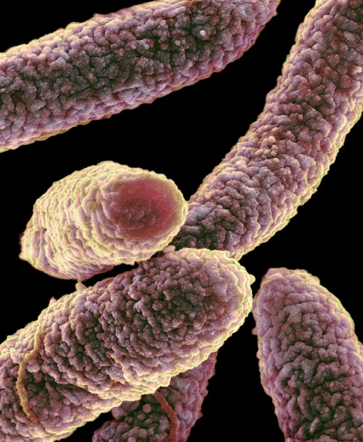 Escherichia Coli Photograph - E. Coli Bacteria #10 by Science Photo Library
