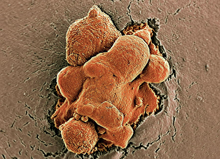 Embryonic Stem Cells #10 Photograph by Professor Miodrag Stojkovic/science Photo Library