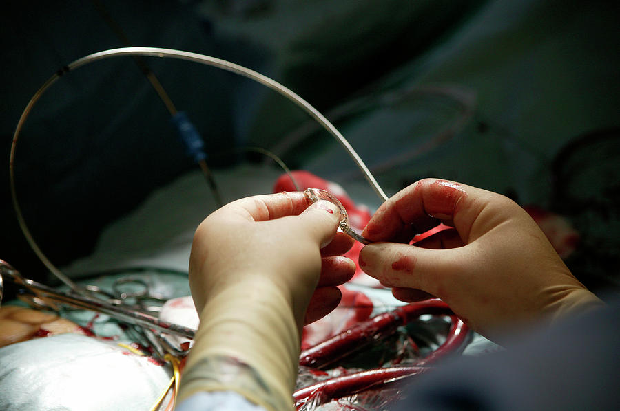 Heart Valve Surgery #10 Photograph by Antonia Reeve/science Photo Library