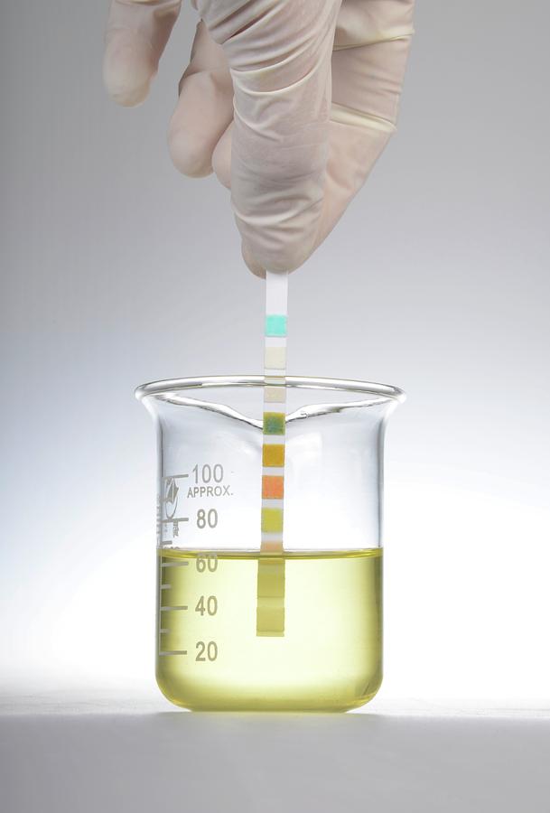 Adult Photograph - Home Urine Test #10 by Cordelia Molloy