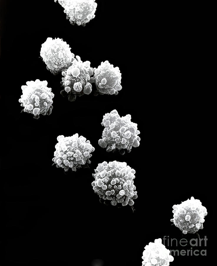 Lymphocytes Undergoing Apoptosis, Sem #10 Photograph by David M. Phillips