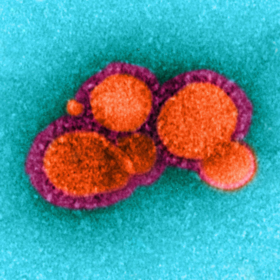Mers-cov Middle East Respiratory #10 Photograph by Science Source
