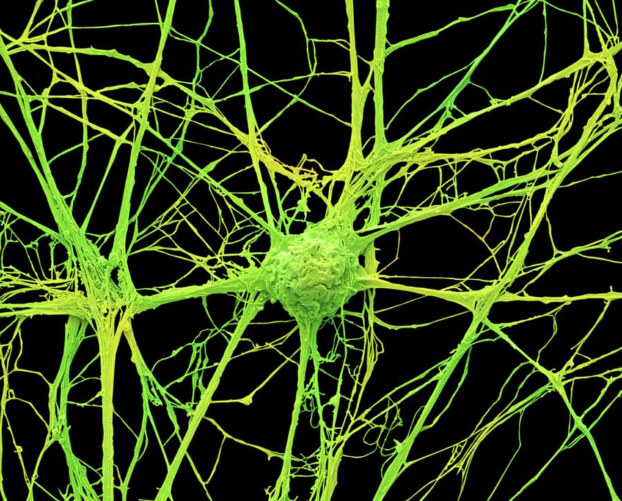 Neurone #10 Photograph by Steve Gschmeissner