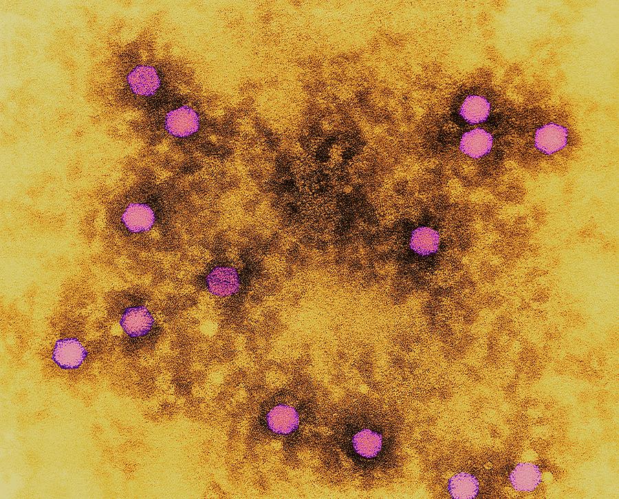 Polio Virus Photograph by Dennis Kunkel Microscopy/science Photo