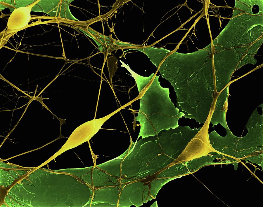 Pyramidal Neurons From Cns #10 Photograph by Dennis Kunkel Microscopy/science Photo Library