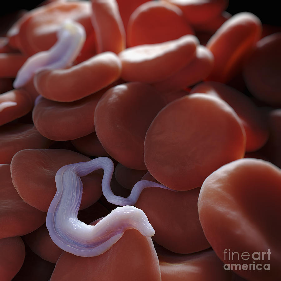 Infection Photograph - Sleeping Sickness Infection #10 by Science Picture Co