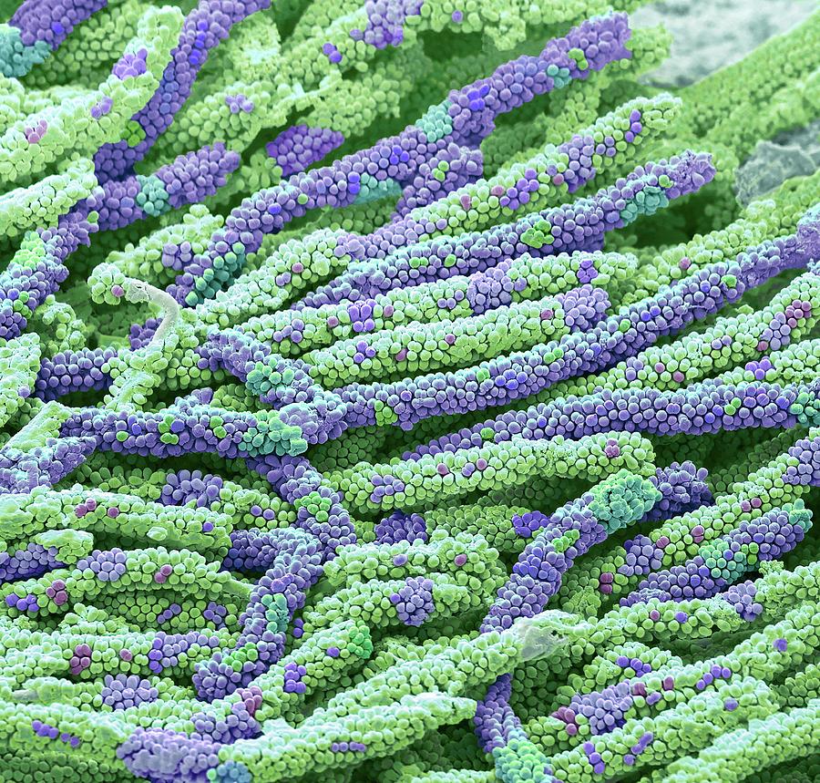 Tooth Bacteria #10 Photograph by Steve Gschmeissner/science Photo Library