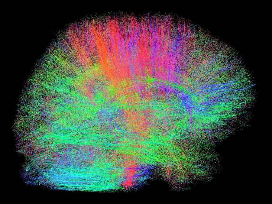 White Matter Fibres Of The Human Brain #10 Photograph by Alfred Pasieka/science Photo Library