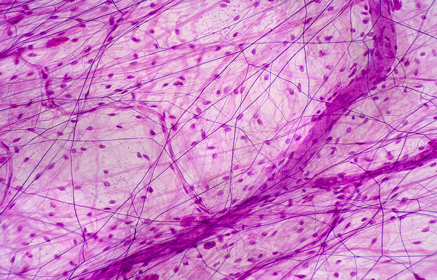 areolar connective tissue