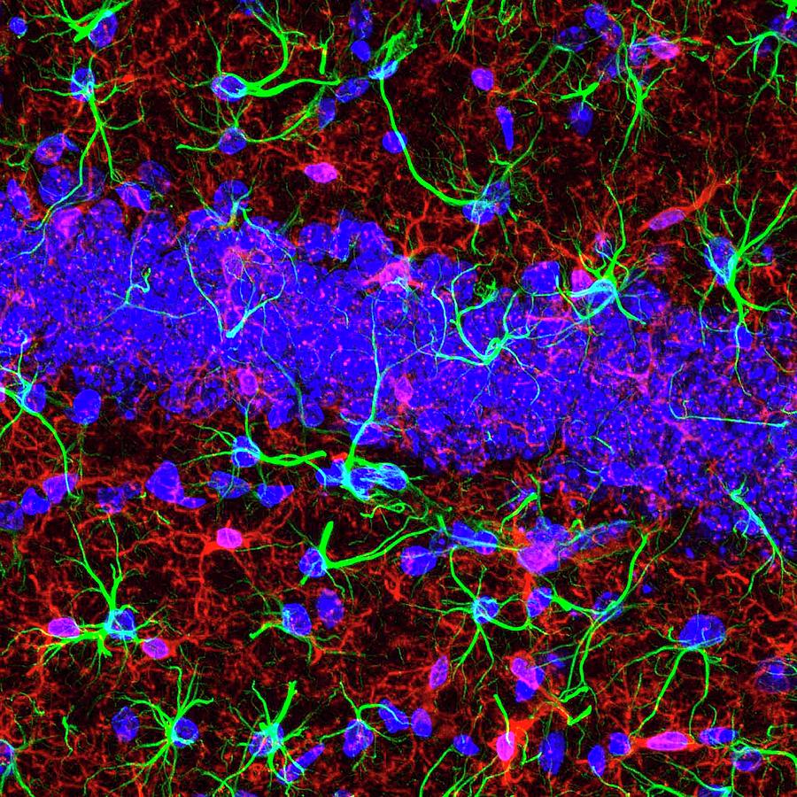 Brain Cells #11 Photograph by Dr. Chris Henstridge