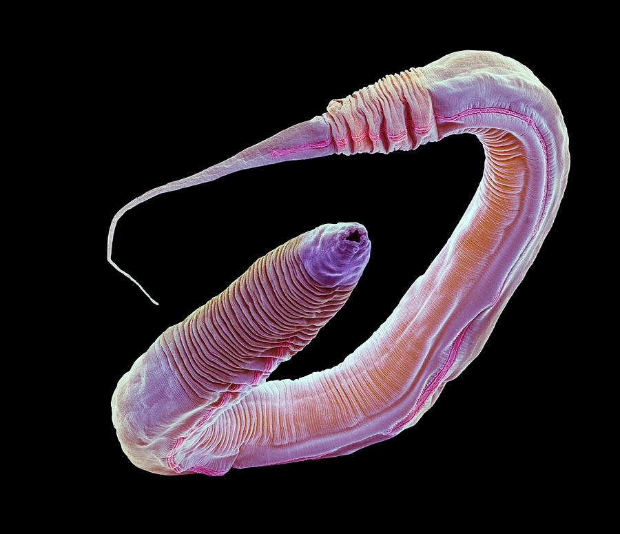 C. Elegans Worm #11 Photograph by Steve Gschmeissner