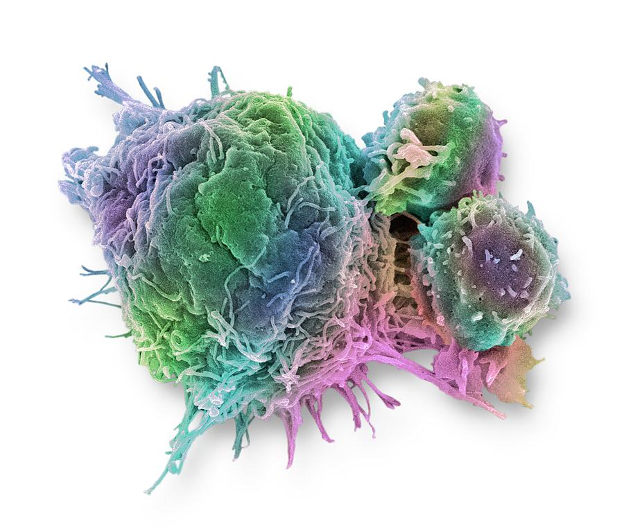 Cancer Cell And T Lymphocytes #11 Photograph by Steve Gschmeissner