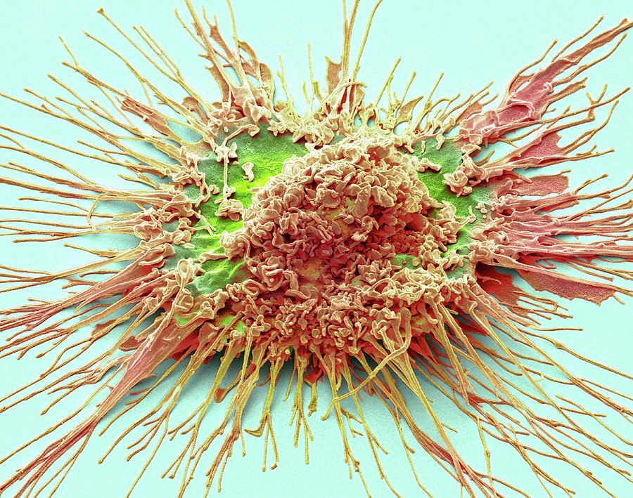 Dendritic Cell #11 Photograph by Steve Gschmeissner