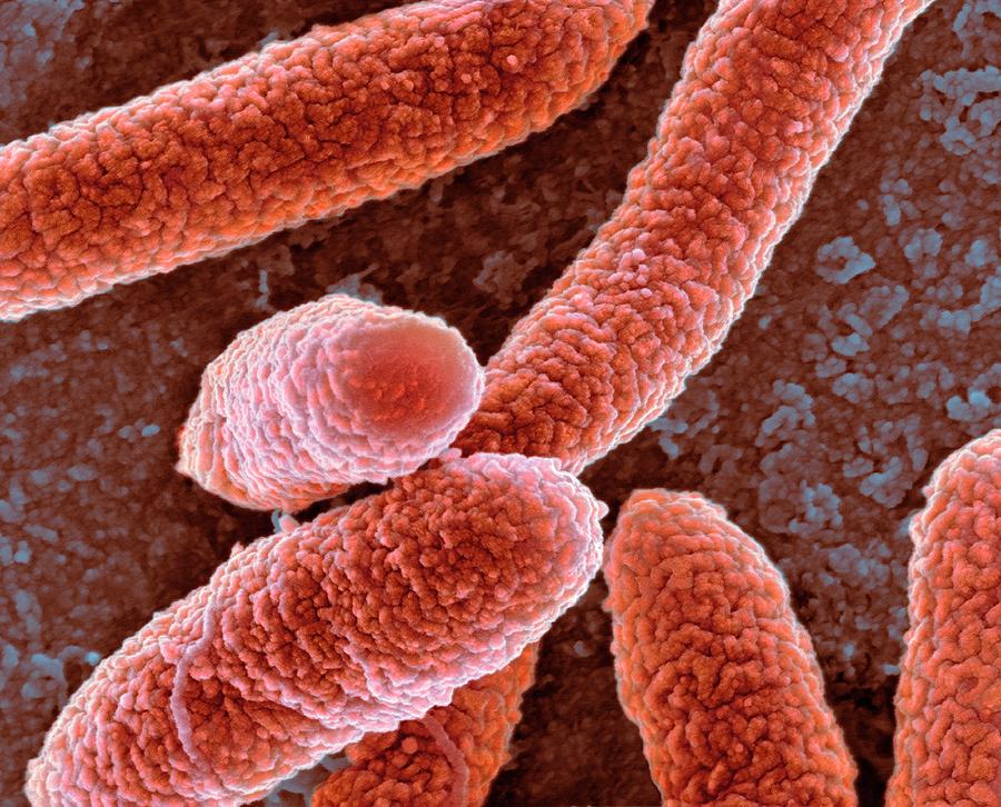 Escherichia Coli Photograph - E Coli Bacteria #11 by Science Photo Library