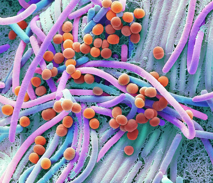 Faecal Bacteria #11 Photograph by Steve Gschmeissner/science Photo Library