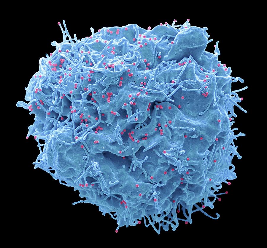 Hiv Infected Cell #11 Photograph by Steve Gschmeissner/science Photo ...